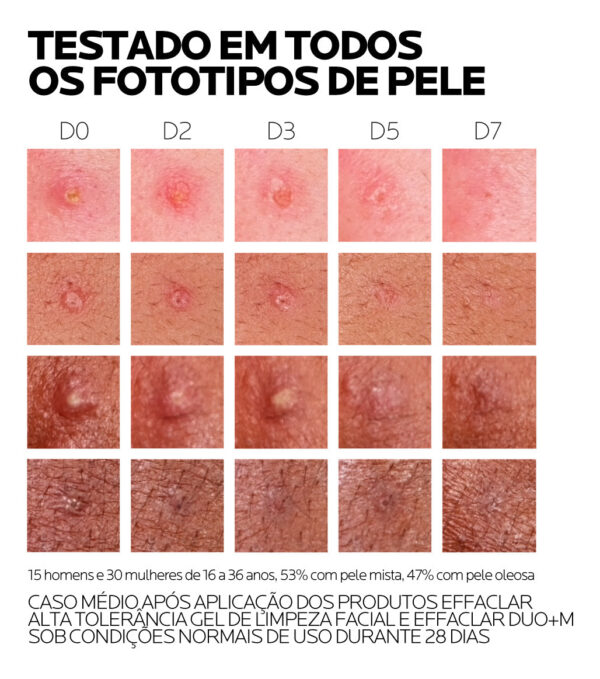 EFFACLAR DUO+ M CREMA ANTIACNE 40ml - Imagem 8