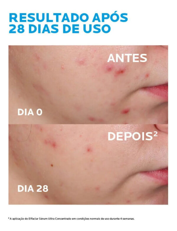 EFFACLAR SÉRUM ULTRA CONCENTRADO 15ml - Imagem 4